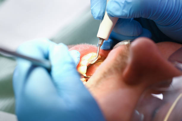 Best After-Hours Emergency Dentist in Burleson, TX