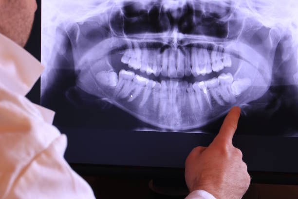 Best Emergency Orthodontic Repairs in Burleson, TX