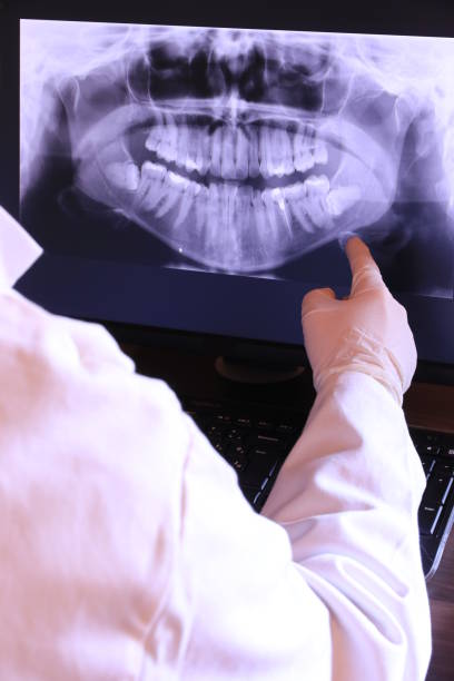 Best Emergency Treatment for Toothache in Burleson, TX