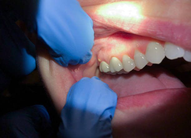 Best Walk-In Emergency Dentist in Burleson, TX